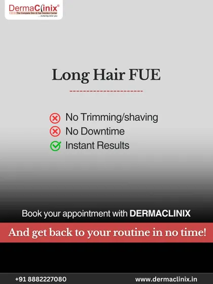 The key benefits of Long Hair FUE are simple: no trimming or shaving, no downtime, and instant results. You can get back to your routine in no time.