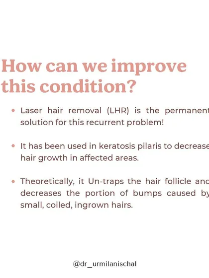 For the recurrent problem of keratosis pilaris, laser hair removal (LHR) is the most effective permanent solution. It works by reducing hair growth in the affected areas, which helps to un-trap the coiled, ingrown hairs that cause the bumps.