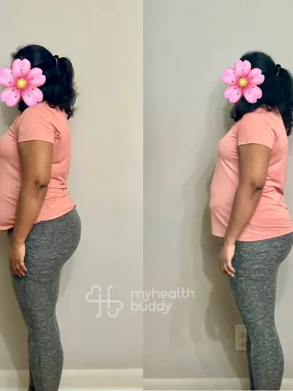 This client lost 5 kgs in 3 months, even with a hectic life overseas and an ankle injury. We modified her workouts to focus on recovery and strength, proving that setbacks don't have to stop your progress.