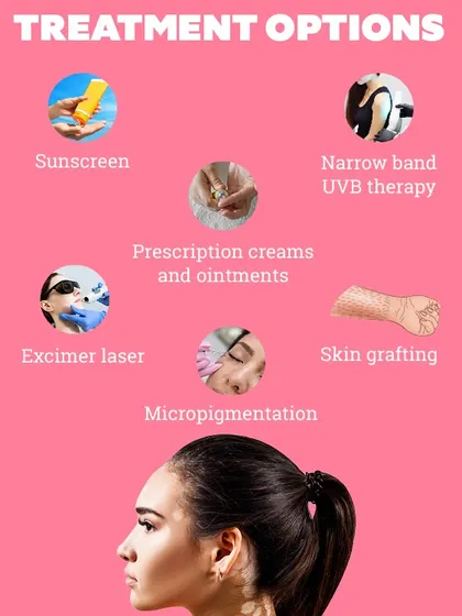 There are multiple effective treatment options for vitiligo, as shown in this infographic. I create a personalized plan for each patient that may include prescription creams, narrowband UVB therapy, Excimer laser, or even skin grafting.