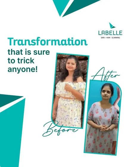 Our weight loss transformations are designed to make you look and feel like a new person. We focus on healthy, sustainable results that bring out the best version of you.