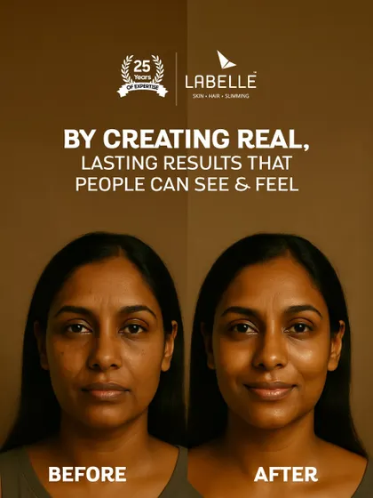 We build trust by creating real, lasting results that people can see and feel. This before and after image is a testament to the visible transformations we achieve.