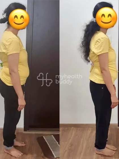 Side view of her 8 kg weight loss. Her new lifestyle is sustainable and there's no looking back.