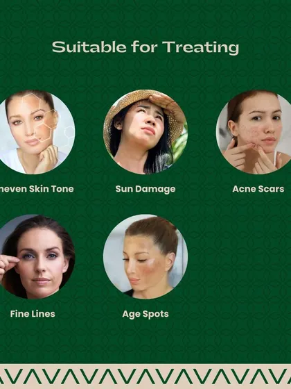 Tribeam laser is versatile and suitable for treating a range of concerns. I use it to address uneven skin tone, sun damage, acne scars, fine lines, and age spots, making it a valuable tool in my practice.