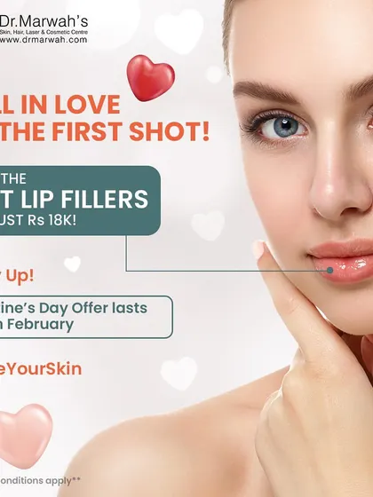 This graphic highlights a Valentine's Day promotion for lip fillers. We use these treatments to provide natural-looking hydration and subtle volume, enhancing the lips for a refreshed appearance.