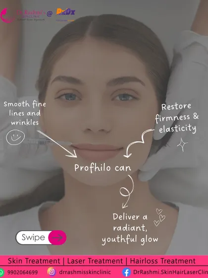 Profhilo is a versatile treatment that can smooth fine lines, restore firmness, and deliver a radiant glow. This graphic illustrates the key areas and benefits of this powerful bio-remodeling injectable.