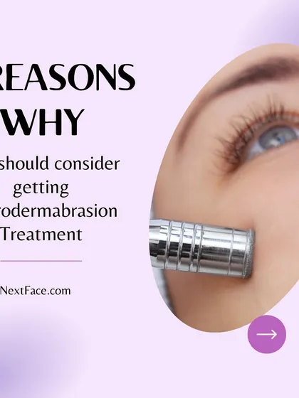 Here are 5 reasons why you should consider getting regular microdermabrasion treatments.