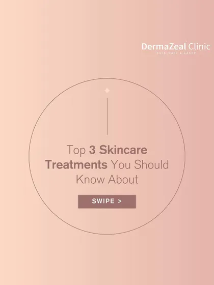 This graphic introduces three top skincare treatments you should know about. Understanding options like chemical peels, carbon laser peels, and microdermabrasion helps you make informed choices.
