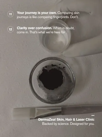 This image shows the tools of the trade for a Carbon Laser Peel. The carbon paste and brush are prepared for application, symbolizing my clinic's motto: "Backed by science. Designed for you."
