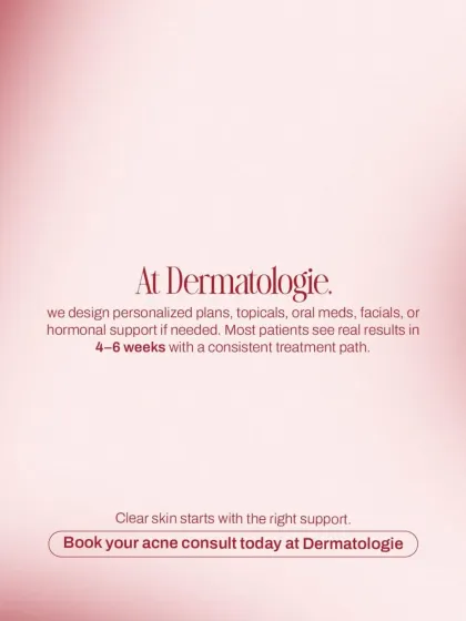 At my clinic, we design comprehensive acne treatment plans that may include topicals, oral medications, or hormonal support. With a consistent approach, most patients achieve visible results within 4-6 weeks.