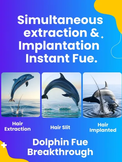 Our "Dolphin FUE" or Instant FUE technique is a breakthrough. Like a dolphin's seamless movement, we perform simultaneous extraction and implantation. This minimizes the time grafts spend outside the body, significantly improving their survival and your final results.