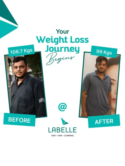 Your weight loss journey begins here. This client went from 108.7 kgs to 99 kgs, proving that with the right support and treatment, significant, healthy change is within reach.