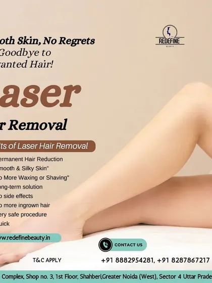 Our laser hair removal is a very safe procedure that provides a permanent reduction in hair growth. This is a long-term solution for smooth, silky skin without regrets.