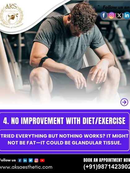 Have you tried diet and exercise without seeing any improvement in your chest area? This is often because gynecomastia involves glandular tissue, not just fat, which requires surgical removal.