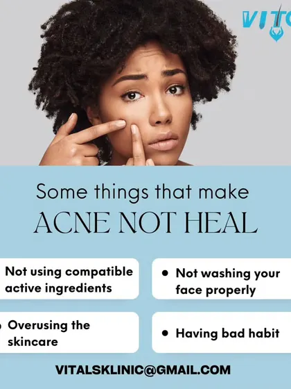 If your acne isn't healing, certain habits might be to blame. This graphic points out common mistakes, such as using incompatible ingredients, overusing products, or not washing your face properly, which can prevent your skin from recovering.