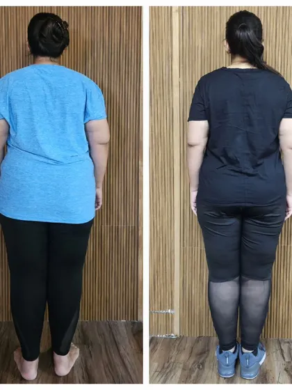 A before-and-after from the back, showing improved posture and a significant reduction in body fat.
