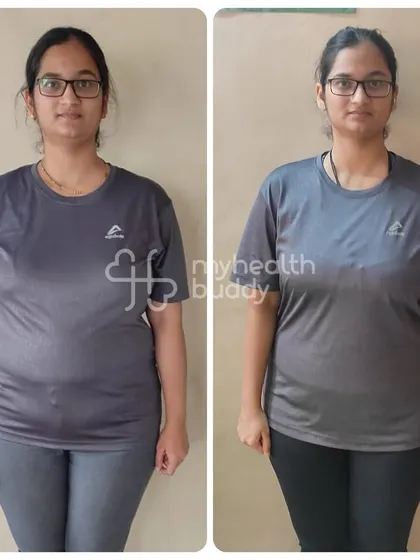 A front view of Kshitija's 11kg weight loss. She was amazed that the diet didn't require any fancy ingredients and was simple to maintain alongside her busy life.