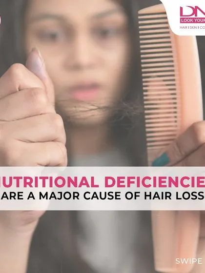 Nutritional deficiencies are a major, yet often overlooked, cause of hair loss. If you're seeing more hair on your comb, it might be time to evaluate your diet and see if you're getting the right vitamins and minerals.