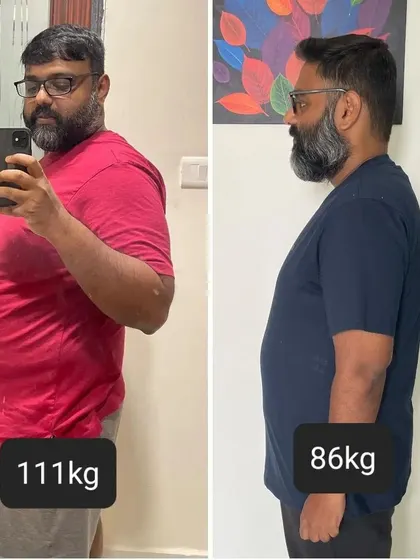 Another angle of the 25kg weight loss transformation. This is the result of sticking to the plan and embracing the journey.