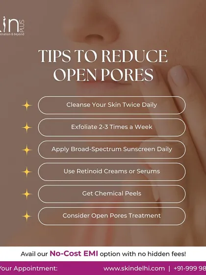 An infographic providing tips to reduce open pores. The advice includes cleansing twice daily, exfoliating regularly, using sunscreen, and considering professional treatments like chemical peels.