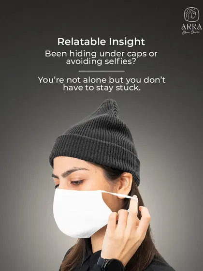 Hiding under caps or avoiding photos because of hair loss is a feeling many share. You are not alone in this, and more importantly, you don't have to stay stuck. There are effective medical solutions available.