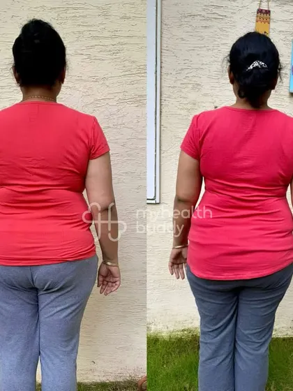 This working woman transformed herself by showing up every single day. Her back is visibly more toned and her posture has improved significantly.