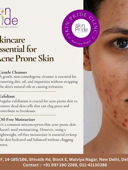 Here are the skincare essentials for acne-prone skin: a gentle cleanser, an exfoliant, and an oil-free moisturizer are crucial for keeping skin balanced.