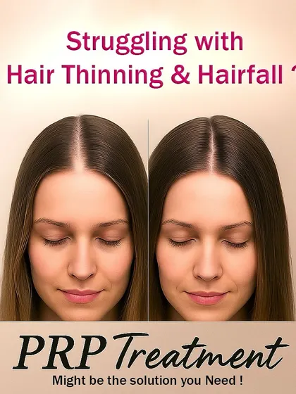 Are you struggling with hair thinning and hair fall? This is one of the most common concerns I hear. PRP treatment is a proven solution that uses your own blood platelets to kickstart natural hair regrowth and give you fuller hair.