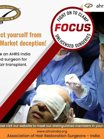 It is vital to choose a certified surgeon for your hair transplant to protect yourself from the grey market. I am a proud member of the Association of Hair Restoration Surgeons of India (AHRS), which advocates for patient safety and ethical practices.
