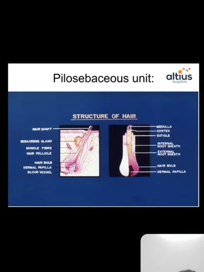 A closer look at the anatomy of a hair follicle, as shown in my presentation. Understanding this structure is fundamental to diagnosing the cause of hair loss and performing effective treatments like FUE and GFC therapy.
