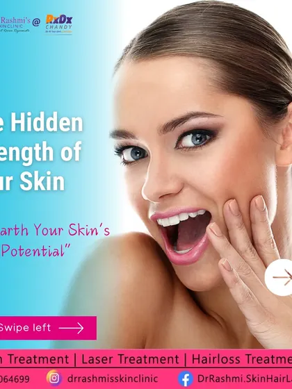 This graphic introduces the idea of unearthing your skin's hidden strength. Profhilo taps into your skin's true potential by revitalizing its deeper layers, empowering it to fight signs of aging and fatigue naturally.