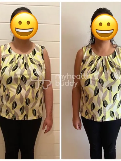Front view of the 7kg loss, a result of patience and consistency.