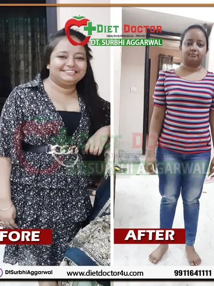 This is a powerful example of how a targeted diet plan can manage chronic health conditions. This client, a chartered accountant with a history of asthma and high BP, not only lost 7 kgs in 3 months but also saw her blood pressure stabilize for the first time in years.
