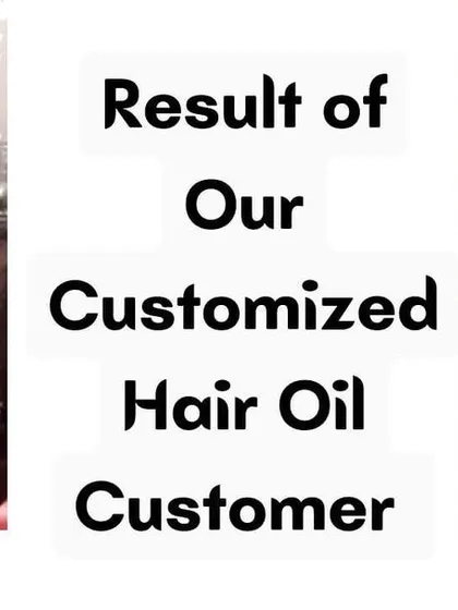 I feel so happy when I see results like this. This is a before and after from a customer who used my customized hair oil to improve her hair's health and volume.