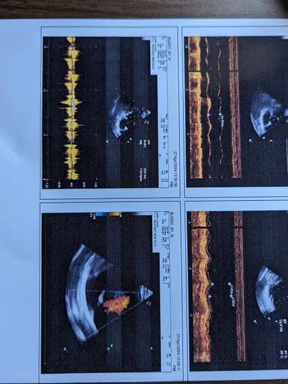 The echo scan images that were part of Buddy's diagnostic fund appeal. Visual proof of the medical care your donations provide.