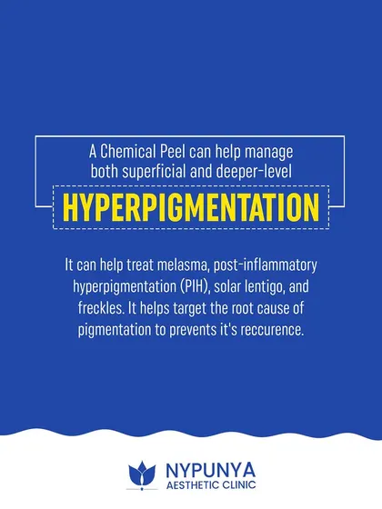 A chemical peel can manage both superficial and deeper-level hyperpigmentation. It helps treat melasma, post-inflammatory hyperpigmentation (PIH), and freckles by targeting the root cause of the pigmentation.