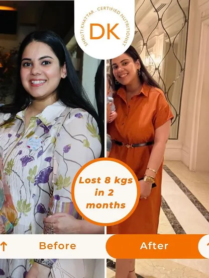 An amazing transformation showing an 8 kg weight loss in just two months. This client's success is a testament to how a consistent, personalized nutrition plan can deliver visible and lasting results without extreme measures.