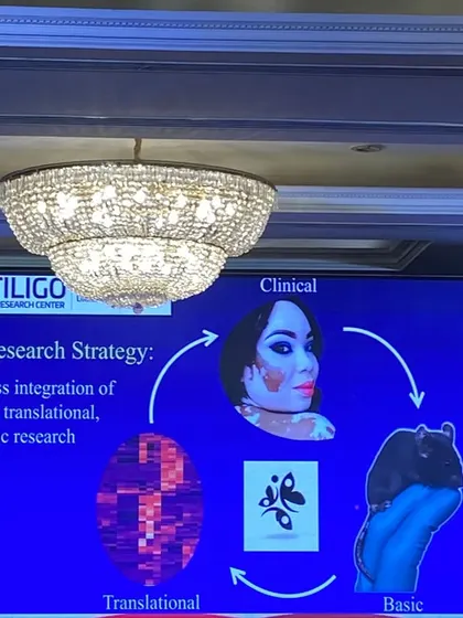A slide from our VFI conference illustrating our research strategy, which focuses on the seamless integration of clinical, translational, and basic research to find better solutions for Vitiligo.