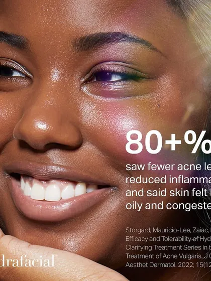 More than 80% of participants in a clinical study saw fewer acne lesions, reduced inflammation, and felt their skin was less oily and congested after HydraFacial treatments.
