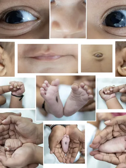 A collage of all the tiny details: eyes, nose, lips, ears, belly button, hands, and feet. These are the precious features you'll want to remember forever.