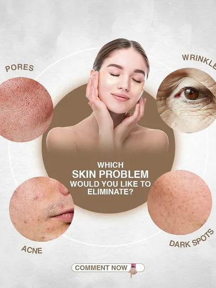 Pores, wrinkles, acne, or dark spots. Which skin problem would you like to eliminate? Let me know, and we can discuss the best treatment for you.