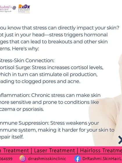 This post delves deeper into the stress-skin connection. It explains how a surge in the stress hormone cortisol stimulates oil production, leading to clogged pores and acne. Chronic stress can also worsen inflammatory conditions like eczema.