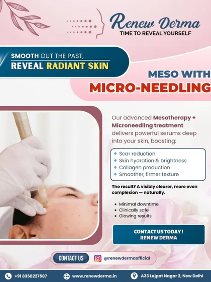 Our Meso with Microneedling treatment delivers powerful serums for scar reduction, hydration, and boosting collagen. It’s a fantastic option for achieving a clearer complexion with minimal downtime.