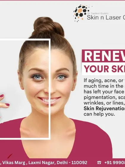 If aging, acne, or sun exposure has left your face with pigmentation, scars, or lines, skin rejuvenation can help. This graphic encourages you to renew your skin and confidence.