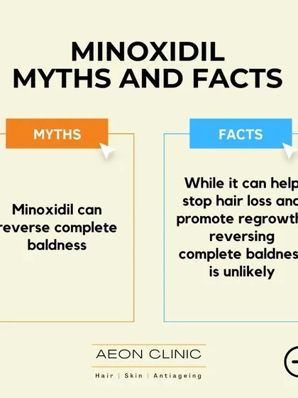Myth: Minoxidil can reverse complete baldness. Fact: While it can help stop hair loss and promote regrowth in active follicles, it is unlikely to reverse complete baldness where follicles are dormant.