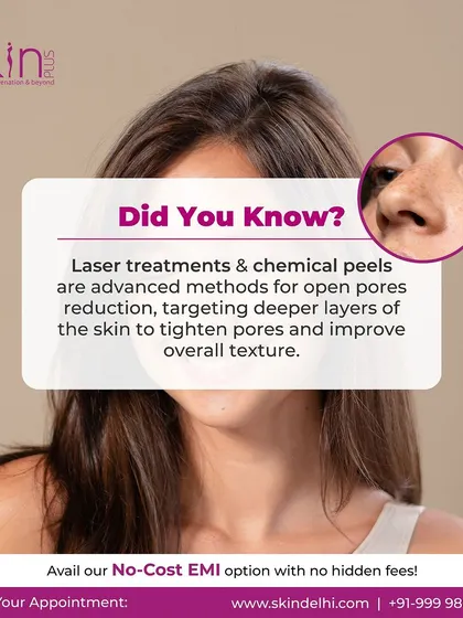 An informational graphic explaining that laser treatments and chemical peels are advanced methods for reducing open pores by targeting deeper layers of the skin to tighten them.