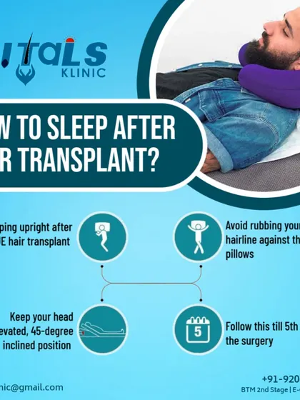 This infographic provides specific instructions on how to sleep after a hair transplant to protect the grafts. We recommend sleeping in an elevated, upright position and avoiding friction against the pillows for the first five days to ensure optimal healing.