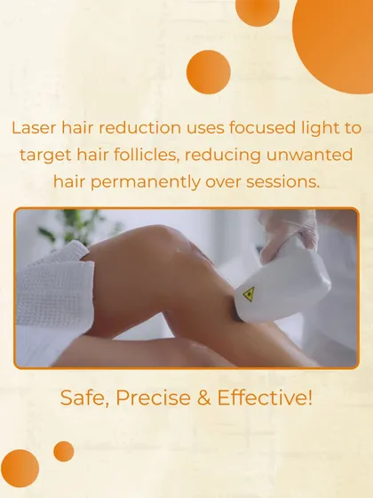 Here you can see our medical-grade laser in action. The process uses a focused beam of light that is absorbed by the pigment in dark, coarse hair. This light energy converts to heat, which damages the hair follicle to inhibit or delay future growth.