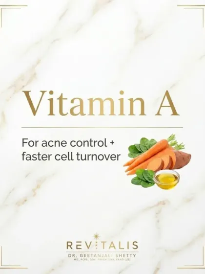 Vitamin A is crucial for acne control and promoting faster cell turnover. This helps keep pores clear and skin looking fresh. You can find it in foods like carrots and sweet potatoes.