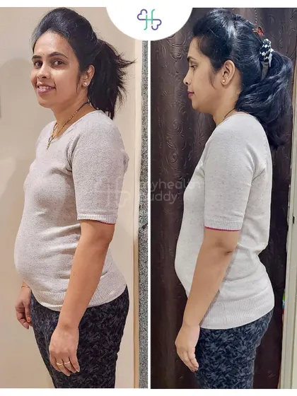 This client went from size XL to M in just 2 months, losing 5 kgs. Her experience shows that with the right guidance, results can be fantastic.